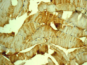 Immunohistochemistry (Formalin/PFA-fixed paraffin-embedded sections) - Anti-Carbo<i></i>nic Anhydrase III [EPR13425] antibody (ab181358)