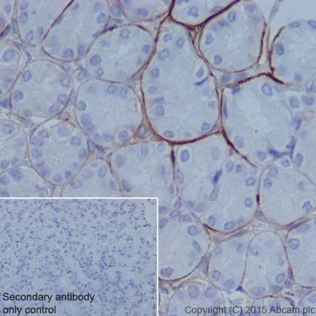 Immunohistochemistry (Formalin/PFA-fixed paraffin-embedded sections) - Anti-Integrin alpha 6 antibody [EPR18124] (ab181551)