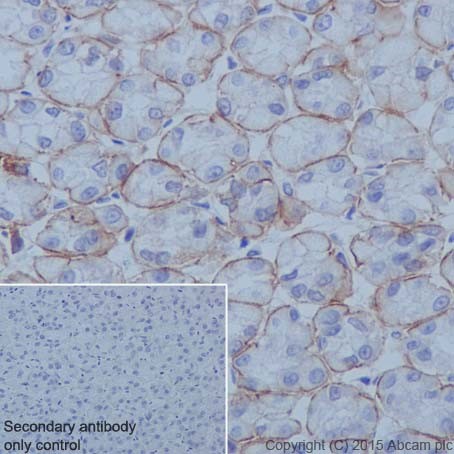 Immunohistochemistry (Formalin/PFA-fixed paraffin-embedded sections) - Anti-Integrin alpha 6 antibody [EPR18124] (ab181551)