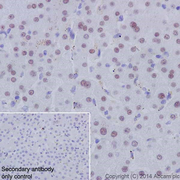 Immunohistochemistry (Formalin/PFA-fixed paraffin-embedded sections) - Anti-HNF-4-alpha antibody [EPR16885] (ab181604)