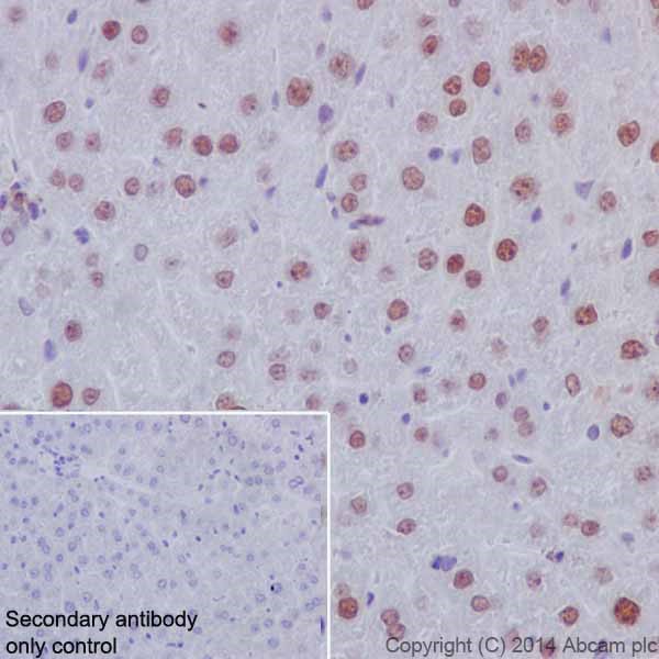 Immunohistochemistry (Formalin/PFA-fixed paraffin-embedded sections) - Anti-HNF-4-alpha antibody [EPR16885] (ab181604)