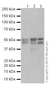 Western blot - Anti-HNF-4-alpha antibody [EPR16885] (ab181604)