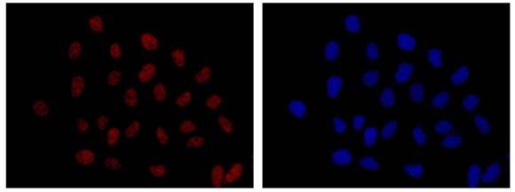 Immunocytochemistry/ Immunofluorescence - Anti-NOL11 [EPR14074-30] antibody (ab181996)