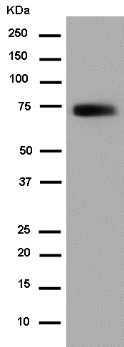 Western blot - Anti-C4BPA [EPR14781(B)] antibody - C-terminal (ab182140)