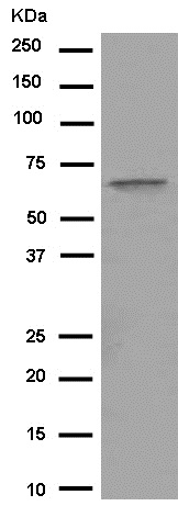 Western blot - Anti-C4BPA [EPR14781(B)] antibody - C-terminal (ab182140)