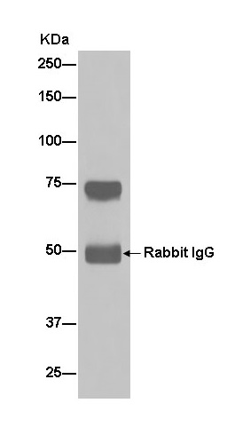 Immunoprecipitation - Anti-C4BPA [EPR14781(B)] antibody - C-terminal (ab182140)