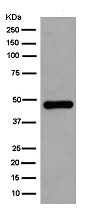 Western blot - Anti-GCDH [EPR14864(B)] antibody (ab182152)