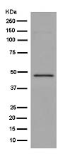 Western blot - Anti-GCDH [EPR14864(B)] antibody (ab182152)