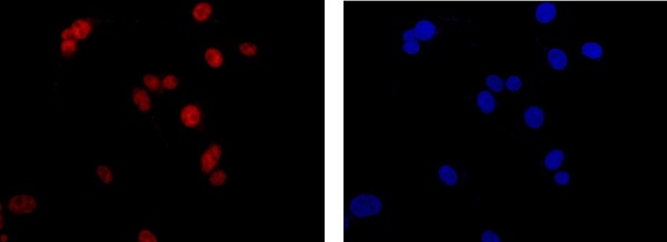 Immunocytochemistry/ Immunofluorescence - Anti-C1orf57 [EPR14325-50] antibody - N-terminal (ab182155)