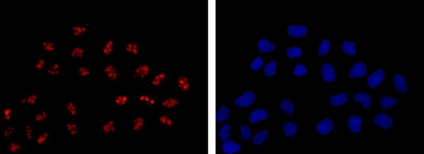 Immunocytochemistry/ Immunofluorescence - Anti-DDX21 [EPR14495] antibody (ab182156)