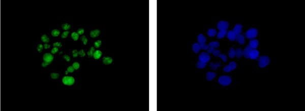 Immunocytochemistry/ Immunofluorescence - Anti-DDX21 [EPR14495] antibody (ab182156)