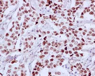 Immunohistochemistry (Formalin/PFA-fixed paraffin-embedded sections) - Anti-DDX21 [EPR14495] antibody (ab182156)