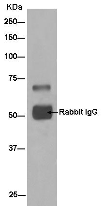 Immunoprecipitation - Anti-KLHL6 [EPR13484] antibody (ab182163)