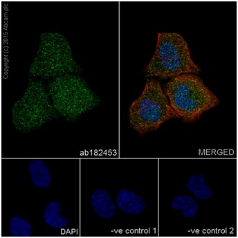 Immunocytochemistry/ Immunofluorescence - Anti-p38 antibody [EPR16878] (ab182453)