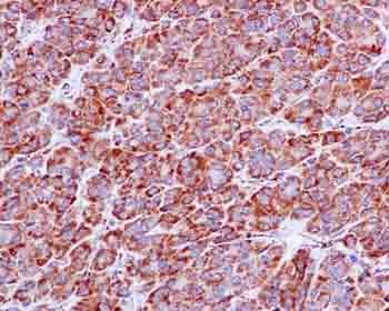 Immunohistochemistry (Formalin/PFA-fixed paraffin-embedded sections) - Anti-NDUFS3 [EPR12781] antibody (ab183733)
