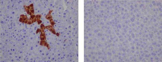 Immunohistochemistry (Formalin/PFA-fixed paraffin-embedded sections) - Anti-GFP [EPR14104-89] antibody (ab183735)
