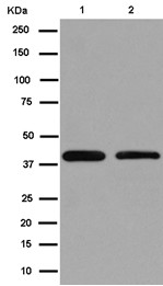 Western blot - Anti-CECR5 [EPR14793(B)] antibody - C-terminal (ab184185)