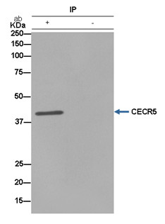 Immunoprecipitation - Anti-CECR5 [EPR14793(B)] antibody (ab184185)