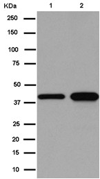 Western blot - Anti-CECR5 [EPR14793(B)] antibody (ab184185)