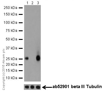Western blot - Anti-PHD3 antibody [EPR17869] (ab184714)