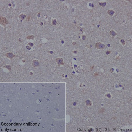 Immunohistochemistry (Formalin/PFA-fixed paraffin-embedded sections) - Anti-PKC alpha + beta 2 + gamma antibody [EPR18104] (ab184746)