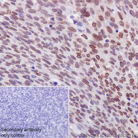 Immunohistochemistry (Formalin/PFA-fixed paraffin-embedded sections) - Anti-PKC alpha + beta 2 + gamma antibody [EPR18104] (ab184746)