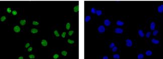 Immunocytochemistry/ Immunofluorescence - Anti-hnRNP Q [EPR15096] antibody (ab184946)