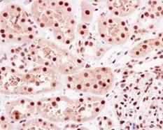 Immunohistochemistry (Formalin/PFA-fixed paraffin-embedded sections) - Anti-hnRNP Q [EPR15096] antibody (ab184946)