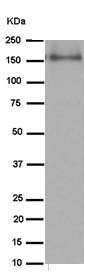 Western blot - Anti-Involucrin [EPR13060(N)] antibody - C-terminal (ab184969)