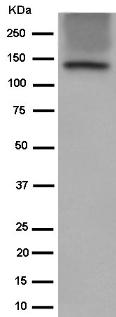 Western blot - Anti-Involucrin [EPR13060(N)] antibody - C-terminal (ab184969)