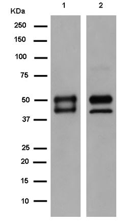 Western blot - Anti-PP11 [EPR15137] antibody (ab185209)