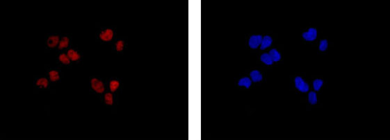 Immunocytochemistry/ Immunofluorescence - Anti-FGD2 [EPR15306] antibody - N-terminal (ab185968)