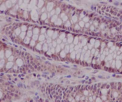 Immunohistochemistry (Formalin/PFA-fixed paraffin-embedded sections) - Anti-FGD2 [EPR15306] antibody - N-terminal (ab185968)