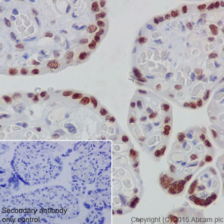 Immunohistochemistry (Formalin/PFA-fixed paraffin-embedded sections) - Anti-GATA3 (phospho S308) antibody [EPR18118] (ab186371)