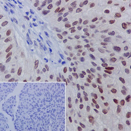 Immunohistochemistry (Formalin/PFA-fixed paraffin-embedded sections) - Anti-GATA3 (phospho S308) antibody [EPR18118] (ab186371)
