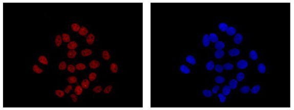 Immunocytochemistry/ Immunofluorescence - Anti-Elav-type RNA-binding protein ETR3 [EPR13374-2] antibody (ab186430)