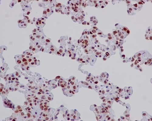 Immunohistochemistry (Formalin/PFA-fixed paraffin-embedded sections) - Anti-Elav-type RNA-binding protein ETR3 [EPR13374-2] antibody (ab186430)