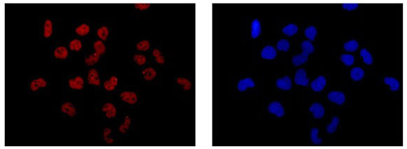 Immunocytochemistry/ Immunofluorescence - Anti-Elav-type RNA-binding protein ETR3 [EPR13374-2] antibody (ab186430)