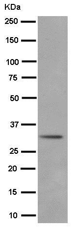 Western blot - Anti-C10orf63 [EPR14013] antibody (ab186433)