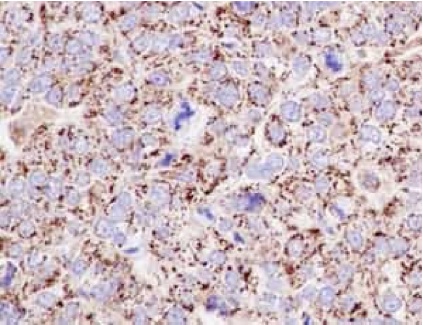 Immunohistochemistry (Formalin/PFA-fixed paraffin-embedded sections) - Anti-Emi1 [EPR15320-103] antibody (ab187144)