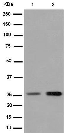 Western blot - Anti-Prostaglandin dehydrogenase 1 [EPR14332-19] antibody (ab187161)