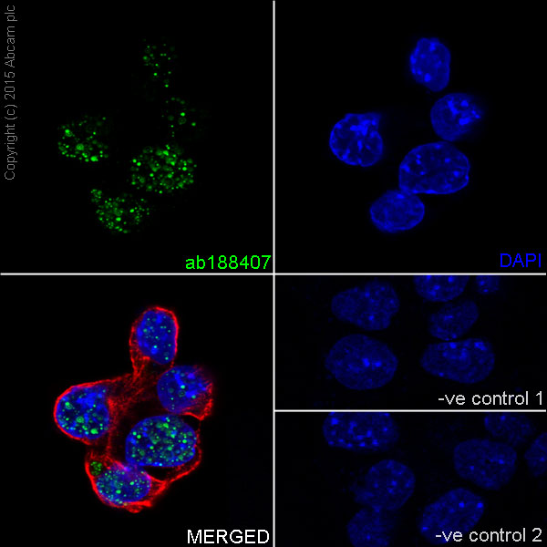 Immunocytochemistry/ Immunofluorescence - Anti-DMAP1 antibody [EPR18179] (ab188407)