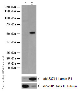 Western blot - Anti-DMAP1 antibody [EPR18179] (ab188407)