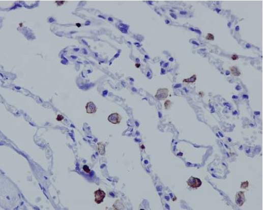 Immunohistochemistry (Formalin/PFA-fixed paraffin-embedded sections) - Anti-MCEMP1 [EPR14393] antibody (ab188572)