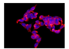 Immunocytochemistry/ Immunofluorescence - Anti-PGM1 [EPR15240] antibody (ab188869)