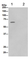 Immunoprecipitation - Anti-PGM1 [EPR15240] antibody (ab188869)