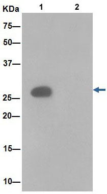 Immunoprecipitation - Anti-ANP32C [EPR13354-70R] antibody (ab189921)