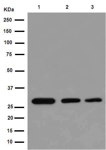 Western blot - Anti-ANP32C [EPR13354-70R] antibody (ab189921)