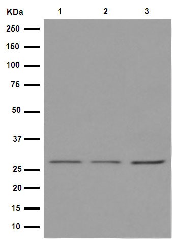 Western blot - Anti-ANP32C [EPR13354-70R] antibody (ab189921)