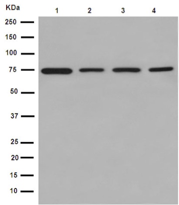 Western blot - Anti-ERp72 [EPR14825] antibody (ab190354)